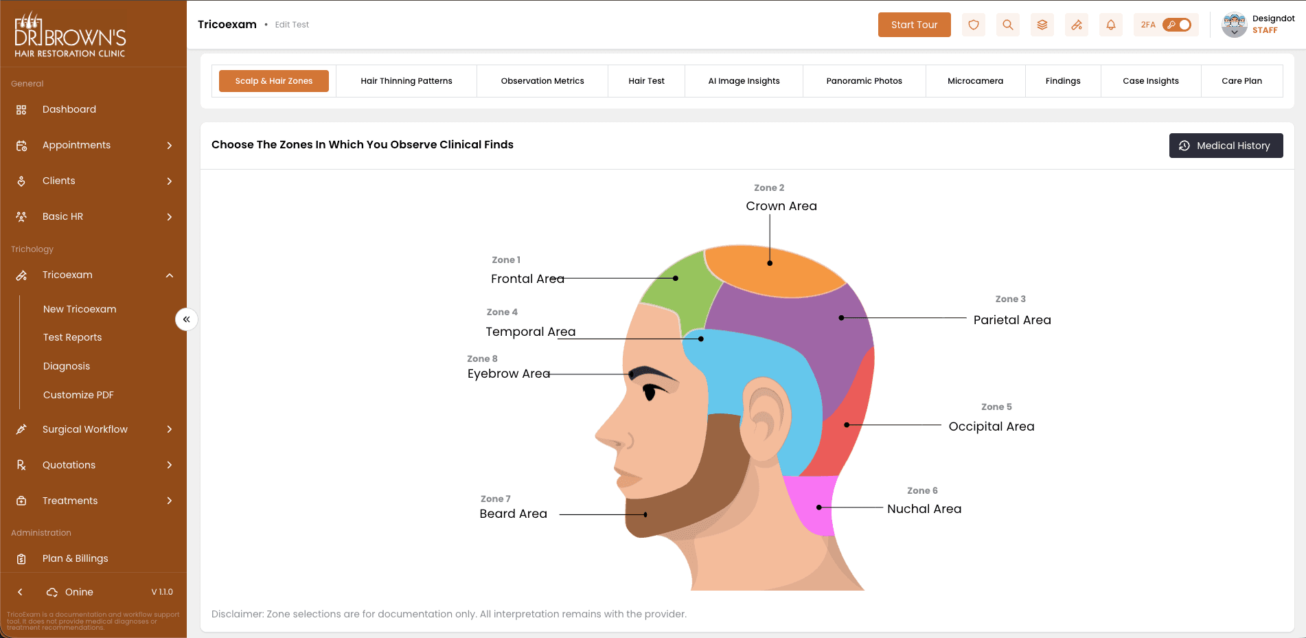 Scalp & Hair Zones