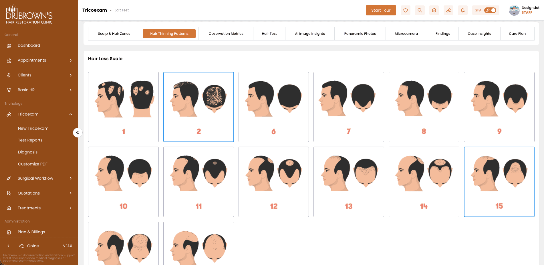 Hair Thinning Patterns